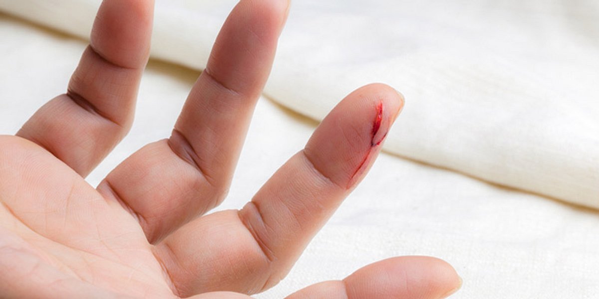 Eine Verletzung am Finger