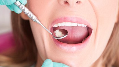 Frau mit gesunden Zähnen - Foto: iStock