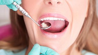 Frau bei einer Zahnarztbehandlung - Foto: iStock/M_a_y_a