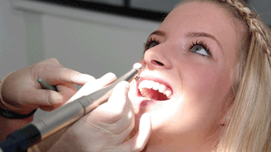 Professionelle Zahnreinigung: medizinisch sinnvoll oder reine Kosmetik?