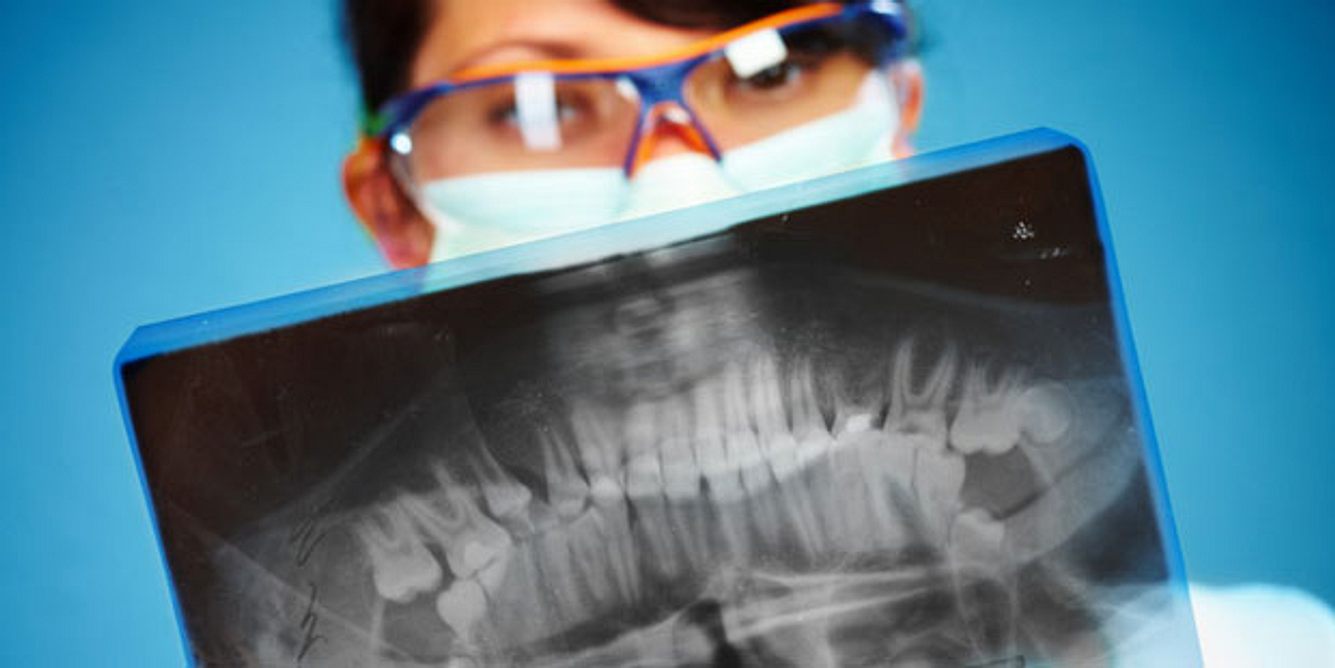 Zahn-Bakterien können Erkrankungen wie Rheuma, Diabetes und Co. fördern