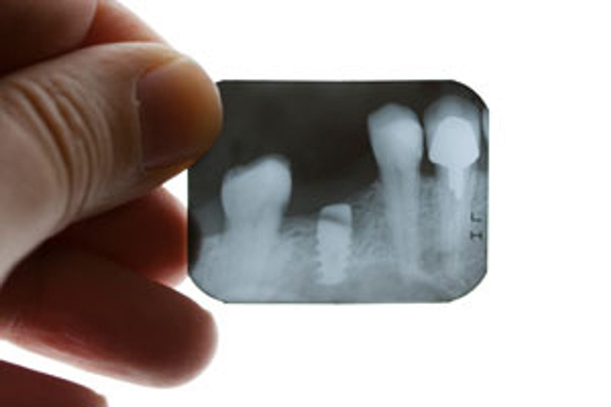 Röntgenaufnahme der Zähne hilft dem Zahnarzt bei der Diagnose von Zahnschmerzen