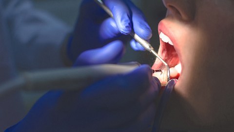 Geöffneter Mund bei einer Zahnbehandlung - Foto: RobertoDavid/iStock
