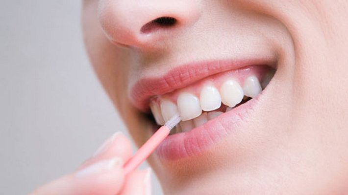 Parodontitis-Ursachen liegen meist in der Mundhygiene