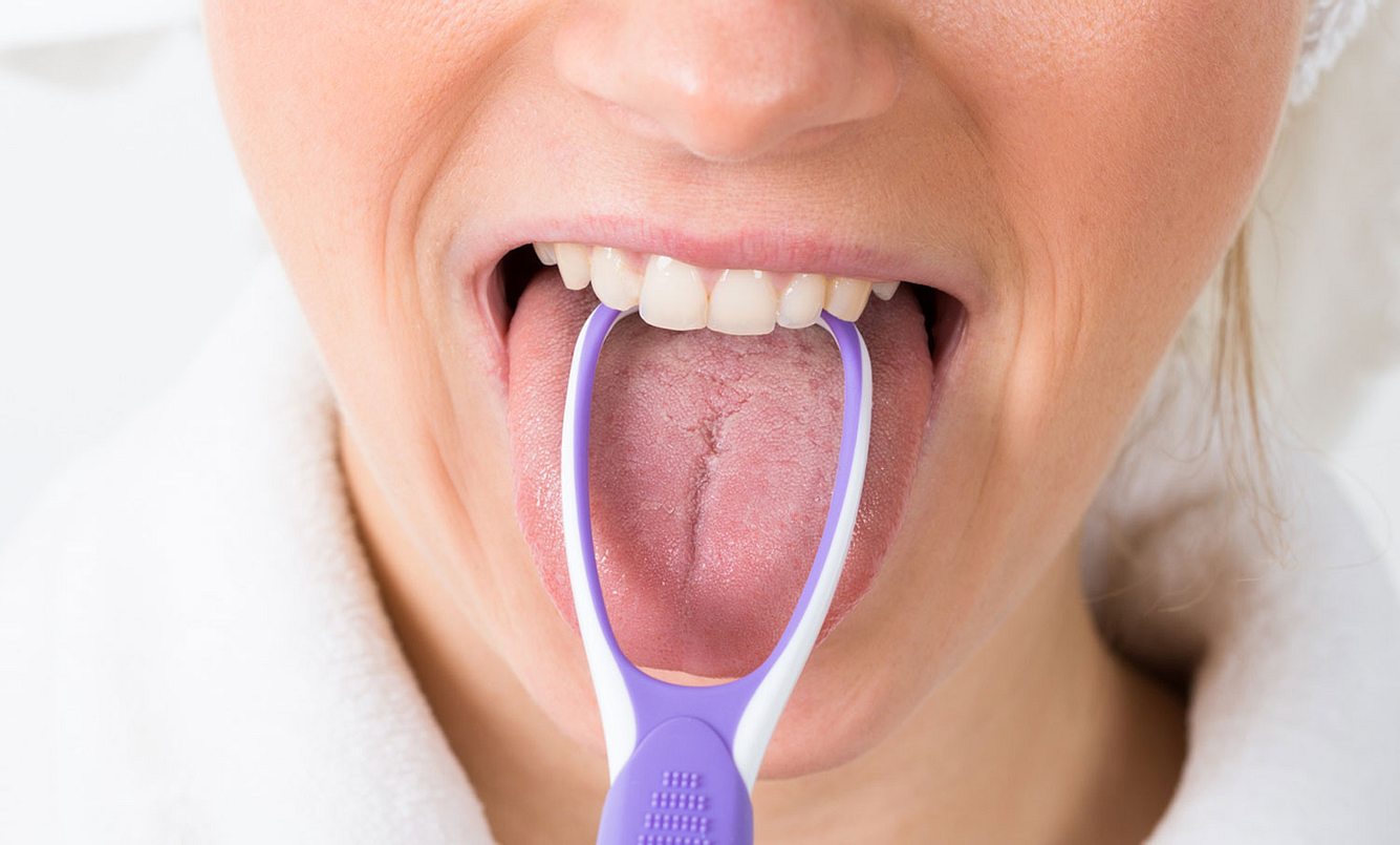 Frau reinigt Zunge mit einem Zungenreiniger