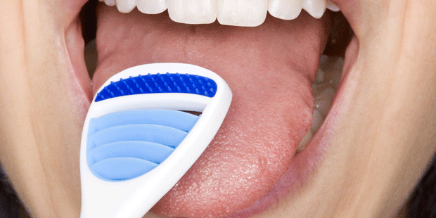 Mit einem Zungenschaber können Sie Ihre Zunge von Belägen befreien
