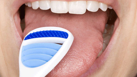 Zungenschaber entfernen Bakterien - Foto: Fotolia